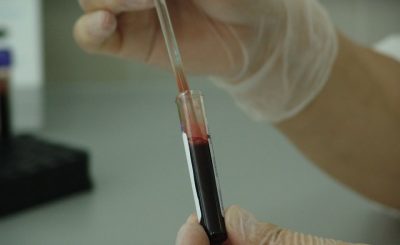This revolutionary blood test identifies severity of chronic pain