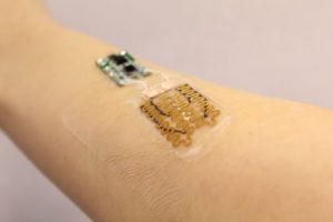 This Smart bandage monitors and medicates chronic wounds when needed