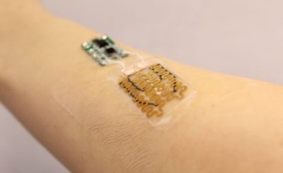This Smart bandage monitors and medicates chronic wounds when needed