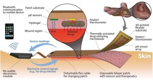 This Smart bandage monitors and medicates chronic wounds when needed